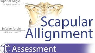 Scapular Alignment and possible causes for dyskinesia [upl. by Small]