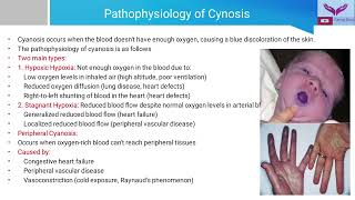 General Examination Cyanosis  Recognizing the Blue Tint  A Guide to Clinical Examination [upl. by Seaman]