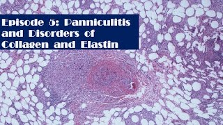 Episode 5 Panniculitis and Disorders of collagen and elastin [upl. by Errised]