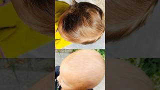 Hair Growth in 1 month haircare baby hairgrowth ytshorts viralvideo [upl. by Chip]