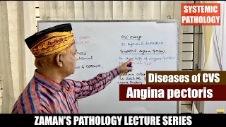 Systemic Pathology Lecture 34  Diseases of CVS  Day 04  Angina pectoris [upl. by Nedra]