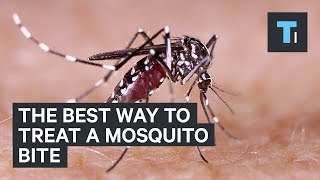 The best way to treat a mosquito bite [upl. by Lahsiv]