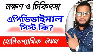 বিনা অপারেশন এপিডিডাইমাল সিস্ট সমাধান🏷️ Epididymal cyst symptoms amp Homeopathic treatment medicine BD [upl. by Letsyrc]