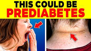 ALERT 11 SIGNS you HAVE PREDIABETES and DON’T KNOW IT  106 [upl. by Skiest989]