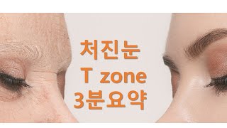 T zone 눈처짐 3분 요약  제이제이성형외과 [upl. by Sonitnatsnok253]