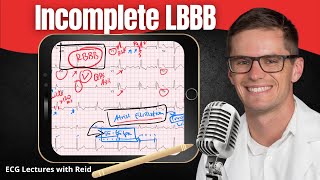 Incomplete Left Bundle Branch Block ILBBB EKG  ECG Lecture [upl. by Marcell]