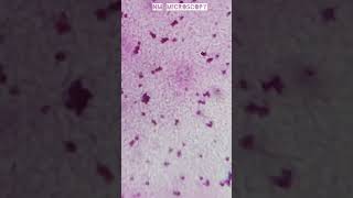 wbc under a microscope 🔬youtube [upl. by Yci]