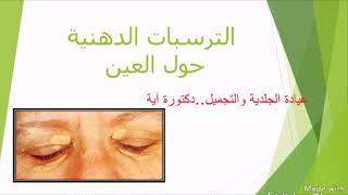 الترسبات الدهنية حول العين اللويحة الصفراء 🔹اسبابها 🔸علاجها 🔹xanthelasma [upl. by Hettie]