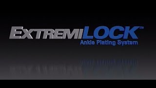 OsteoMed  ExtremiLOCK Ankle Plating System  Ankle Fracture Plating [upl. by Neyu]