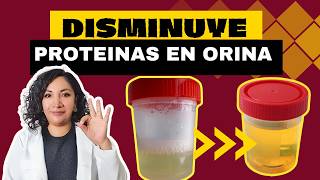 ELIMINA LA PROTEINURIA proteinas en la orina con estos CONSEJOS 👩🏻‍⚕️ [upl. by Gratt294]