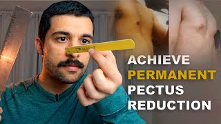 Reduce Pectus Excavatum Depth Permanently [upl. by Oxley668]