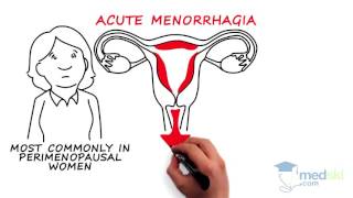 Obstetrics and Gynecology – Abnormal Vaginal Bleeding By Kate Pulman MD [upl. by Sancha391]