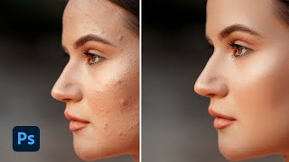 HighEnd skin retouch in 1 minute on photoshop  Photoshop tutorial [upl. by Pembroke]