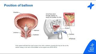 catheterisation presentation [upl. by Naldo]