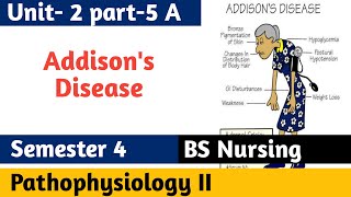 Addisons Disease  Overview causes treatment clinical features pathophysiology investigations [upl. by Anaiv562]