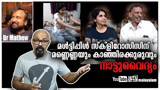 മൾട്ടിപ്പിൾ സ്ക്ളീറോസിസിന് മണ്ണെണ്ണയും കാഞ്ഞിരക്കുരുവും  നാട്ടുവൈദ്യം  MS explained in malayalam [upl. by Benisch]