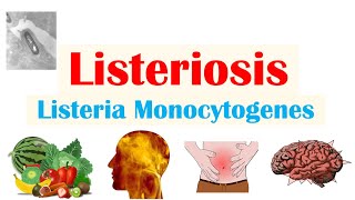 Listeriosis Listeria Monocytogenes  Sources Pathophysiology Symptoms Diagnosis Treatment [upl. by Aketahs]