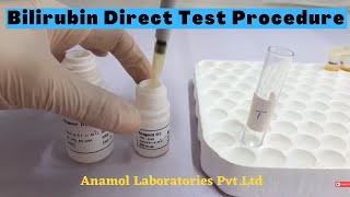 Bilirubin Test Procedure  Bilirubin Direct Test ProcedureIn English [upl. by Joela48]