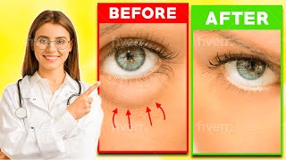 How To Fix Puffy Eyes [upl. by Kirwin]