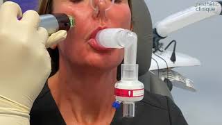 Hyperdilute Radiesse  PRP for Neck Tightening [upl. by Tamberg]