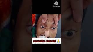 Abnormal Doll’s Eye  Oculocephalic Reflex  hospital eyediseases india mp shorts shortvideo [upl. by Enirehs]