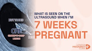 6 Weeks Pregnant Witnessing the First Heartbeat on ultrasound scan [upl. by Nora]