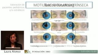 Cover Test y Motilidad Ocular Extrínseca [upl. by Yvan734]