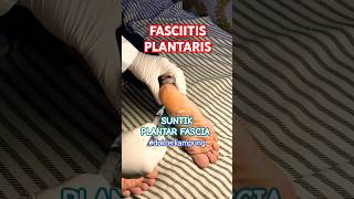 FASCIITIS PLANTARIS  syarhan ruralhealthcare [upl. by Annat531]