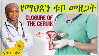 የማህጸን ቱቦ መዘጋት  Closure of the cervix [upl. by Allemac]