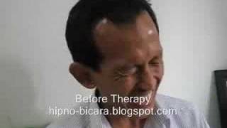 Stammering Stuttering Hypnotherapy  Terapi GAGAP [upl. by Weikert]