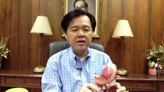 Stomach Ulcer and Hyperacidity Dr Willie Ong Health Blog 24 [upl. by Galatia287]