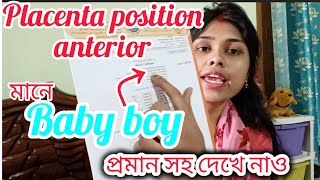 Usg report এ placenta position anterior মানে ছেলে সন্তান প্রমাণসহ দেখে নাও Desi queen ponchu [upl. by Wall249]