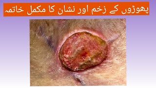 Abscess wounds and scars  Homeo treatment  By DrSohail Janjua [upl. by Ennairol589]