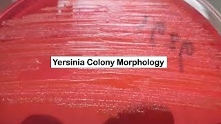 Yersinia enterocolitica Colony Morphology on CLED Agar [upl. by Ridan526]