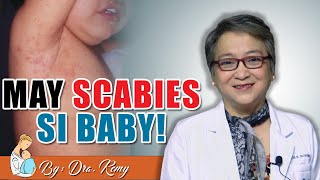 MAY SCABIES SI BABY GALIS ASO [upl. by Tri]