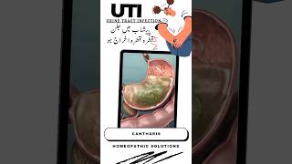 UTI Relief with Homeopathic Medicine  Urine Tract Infection Treatment  Symptoms and Remedy yt [upl. by Ylekalb]