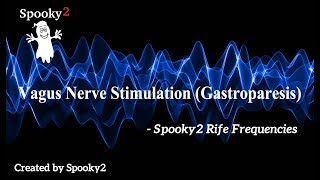 Vagus Nerve Stimulation Gastroparesis  Spooky2 Rife Frequencies [upl. by Olgnaed8]