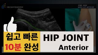 Hip joint anterior scan KAOM 강사 이근우 구미 마디와신경외과 친절한 초음파 대한근골격계초음파학회 [upl. by Suoiradal]