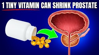 1 Vitamin That Will Change Your Prostate Forever [upl. by Koorb266]