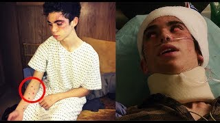 Cameron Boyce Death  The Disturbing Truth [upl. by Eicyac]