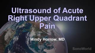 Ultrasound of Acute Right Upper Quadrant Pain [upl. by Eblehs961]