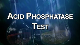 Acid Phosphatase Test [upl. by Kraul]