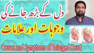 Heart Size  Signs amp Symptoms of enlarged heart  Hypertrophic Heart  Normal Heart in Urdu [upl. by Fuld]