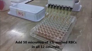 AJs Science 2 How to perform Hemagglutination assay HA Test [upl. by Ardnajela583]