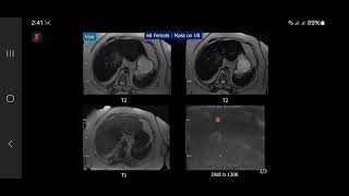 DR KHAN liverbiliary system [upl. by Mahmoud]