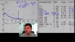 Spirometrie 4  exemplu DVO disfunctie ventilatorie obstructiva [upl. by Scrivens]