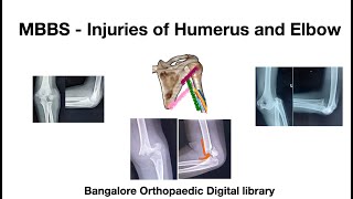 MBBS  Humerus and Elbow injuries [upl. by Fritzie]