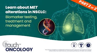 Personalized therapy for NSCLC Biomarker testing treatment and management in MET alterations [upl. by Lehet]