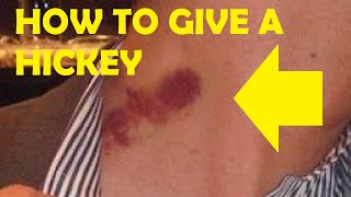 how to give a hickey leaving a mark easy [upl. by Ettenig533]