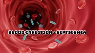 SEPSIS PATHOPHYSIOLOGY OF SEPTICEMIA [upl. by Aidam]